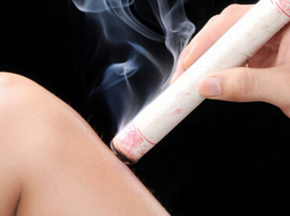 艾炙烫伤怎么办 及时处理治疗防感染